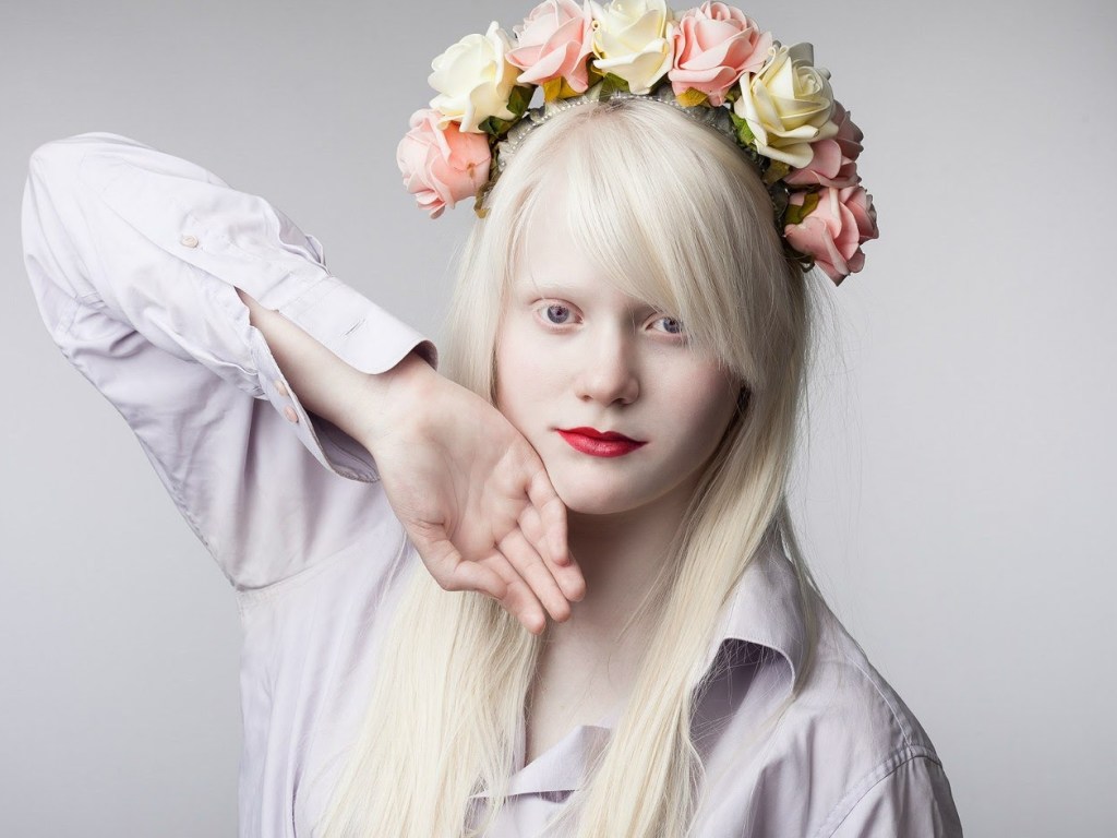 Сегодня Международный день распространения информации об альбинизме