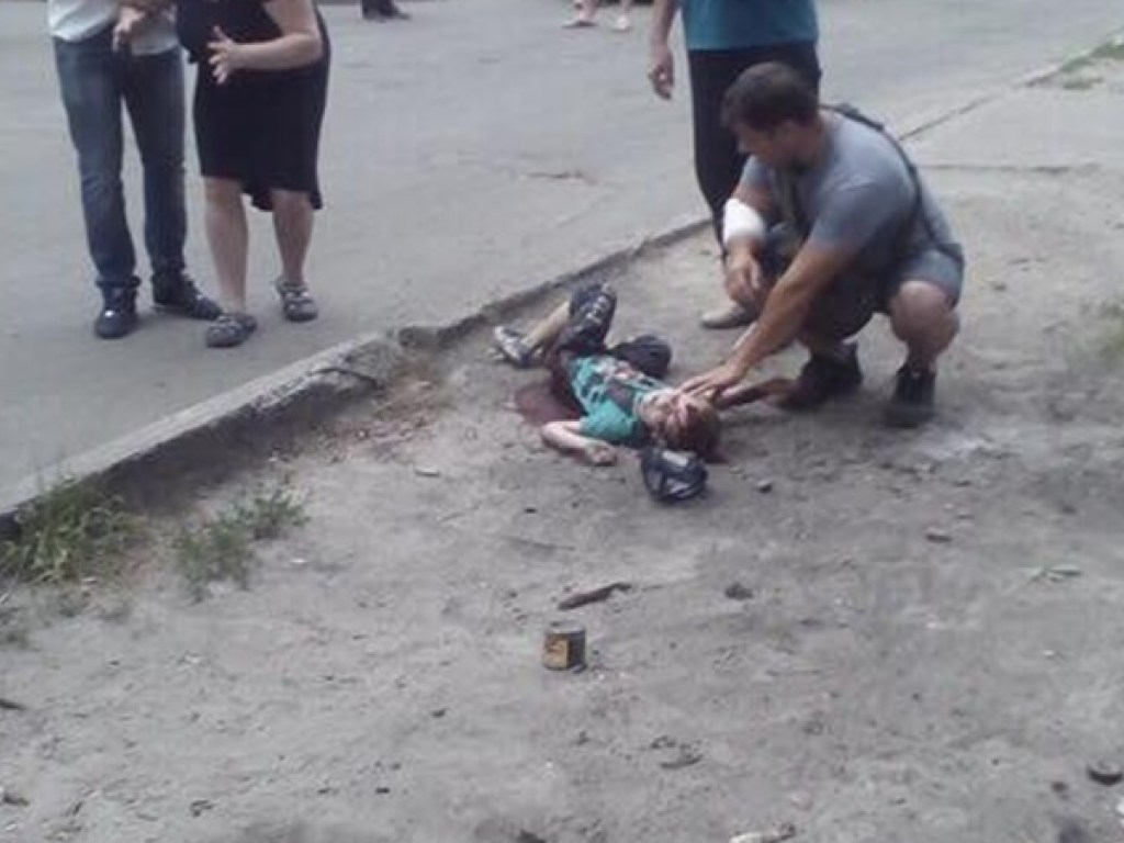 Врач о последствиях взрыва авто в Киеве: для спасения пострадавшего мальчика нужно собрать консилиум специалистов