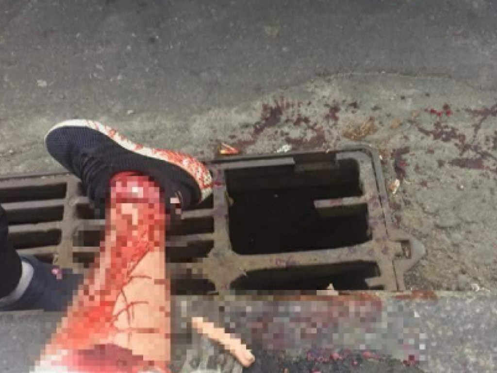 В Киеве парень получил серьёзную травму после падения в ливневую канализацию (ФОТО)