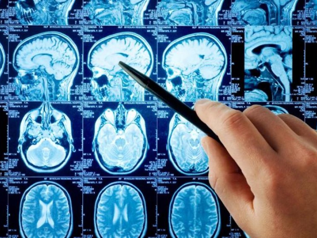 Человеческий мозг впервые заговорил &#8212; ученые