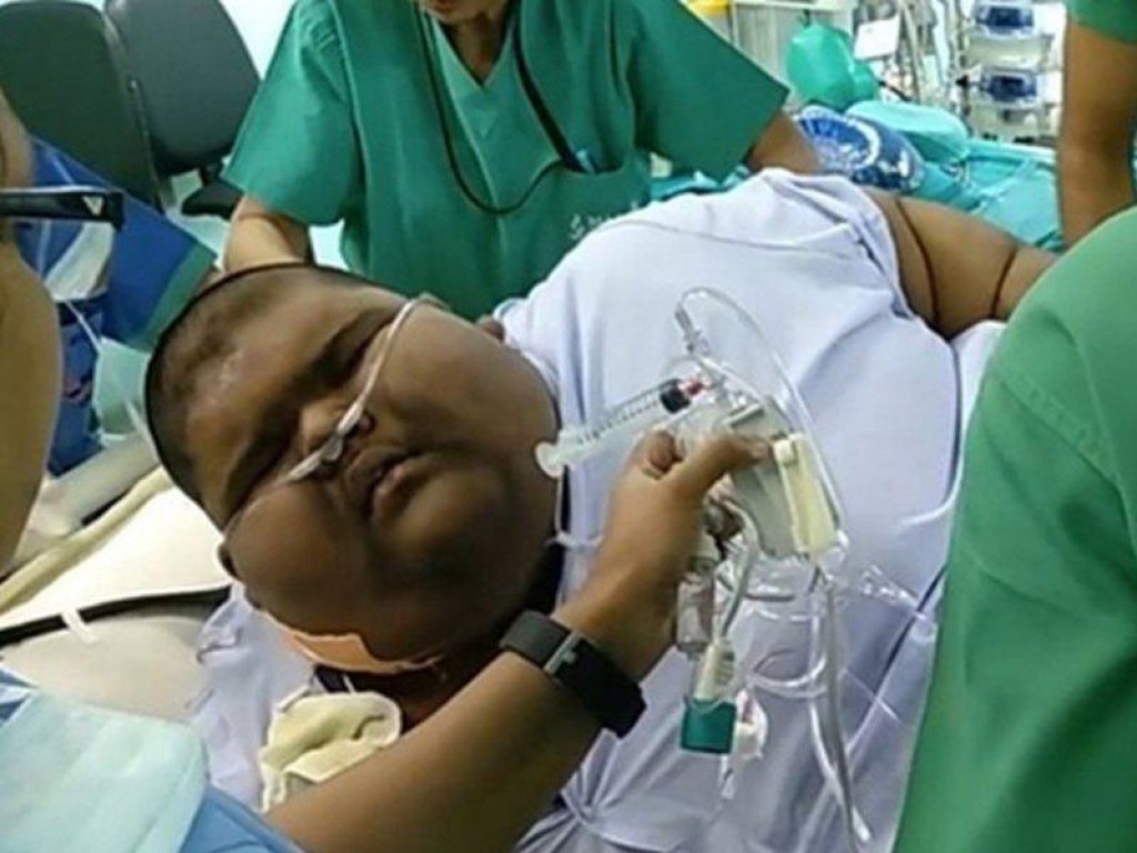 Самый толстый ребенок в мире смог похудеть и прогуляться (ФОТО)