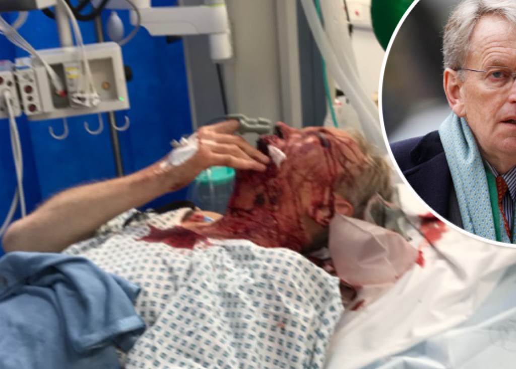 В Лондоне экс-послу Великобритании в США разбили лицо, он госпитализирован (ФОТО)