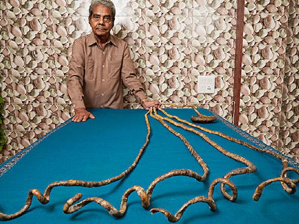 Два метра: у 82-летнего индуса отрезали «болгаркой» самые длинные в мире ногти (ФОТО, ВИДЕО)
