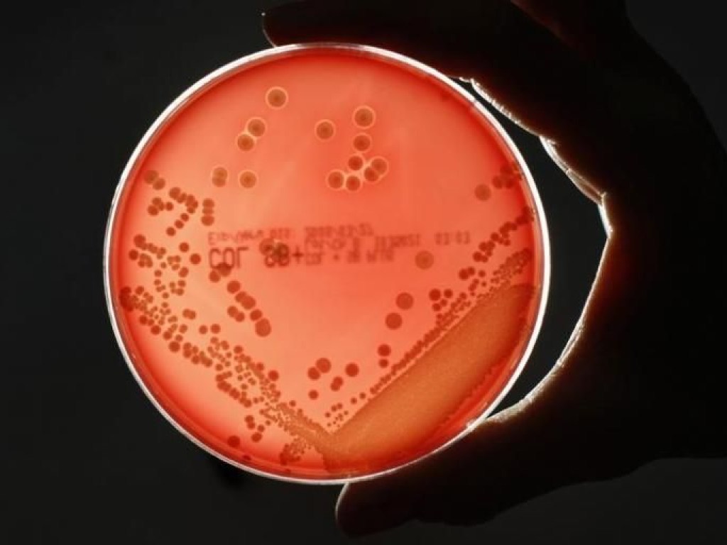 Ученые напугали новой потенциальной супербактерией