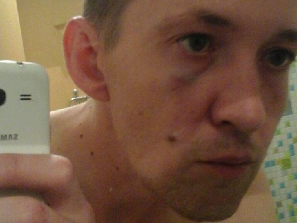 В Николаеве в подъезде собственного дома избили журналиста (ФОТО)