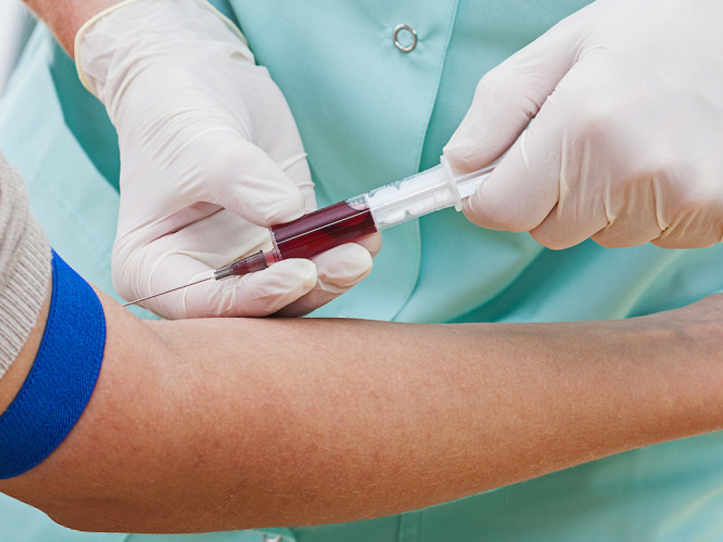 Многие не знают о своем статусе: Два миллиона украинцев инфицированы гепатитом С