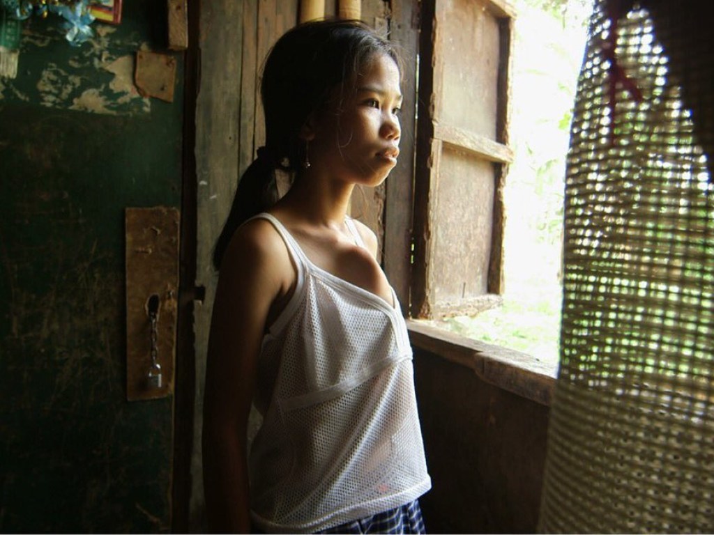 На Филиппинах живет девочка с шестью конечностями (ФОТО)
