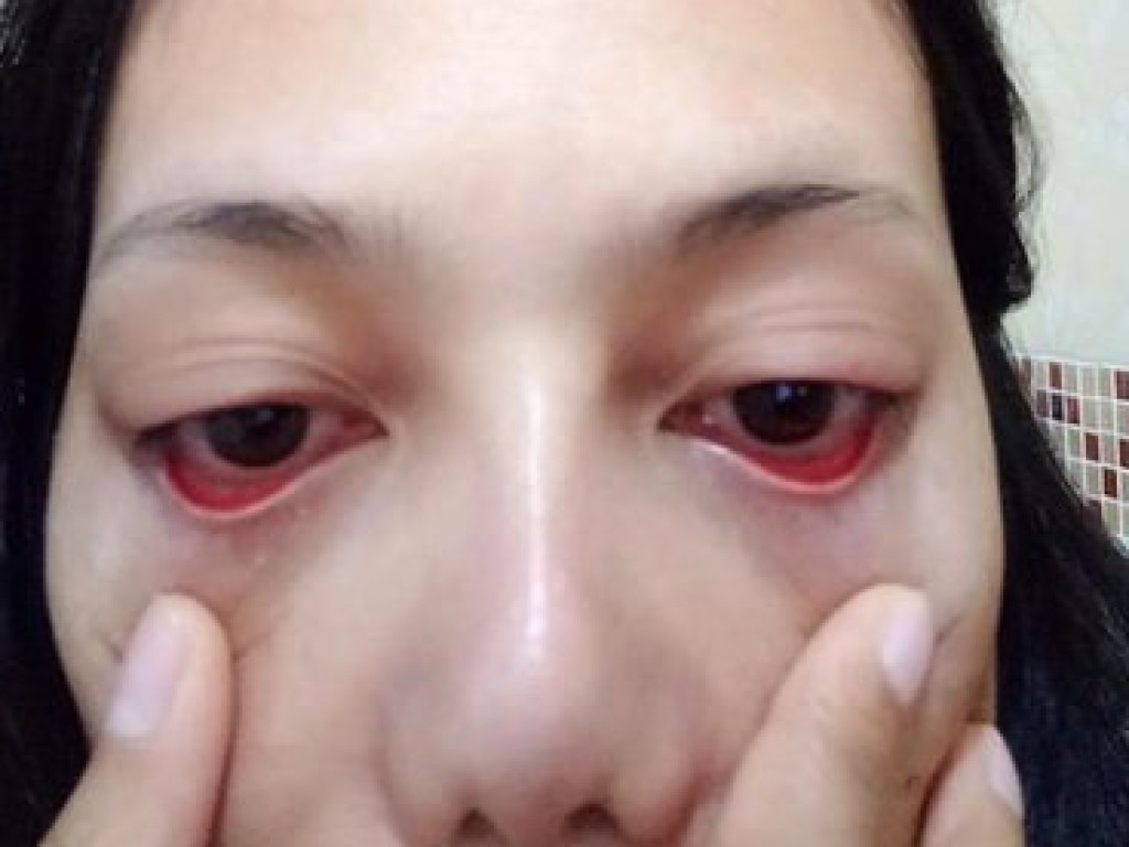 В Таиланде косметолог нарастил клиентке ресницы с помощью суперклея (ФОТО)