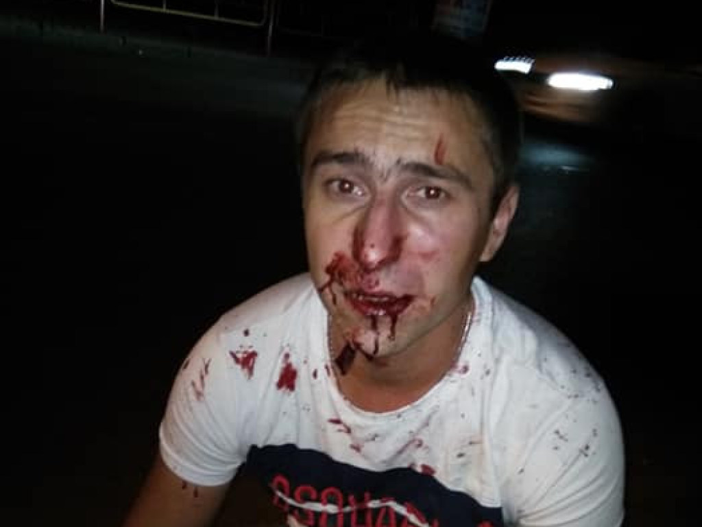 Житель Одессы избил таксиста за непрофессиональное поведение (ФОТО)
