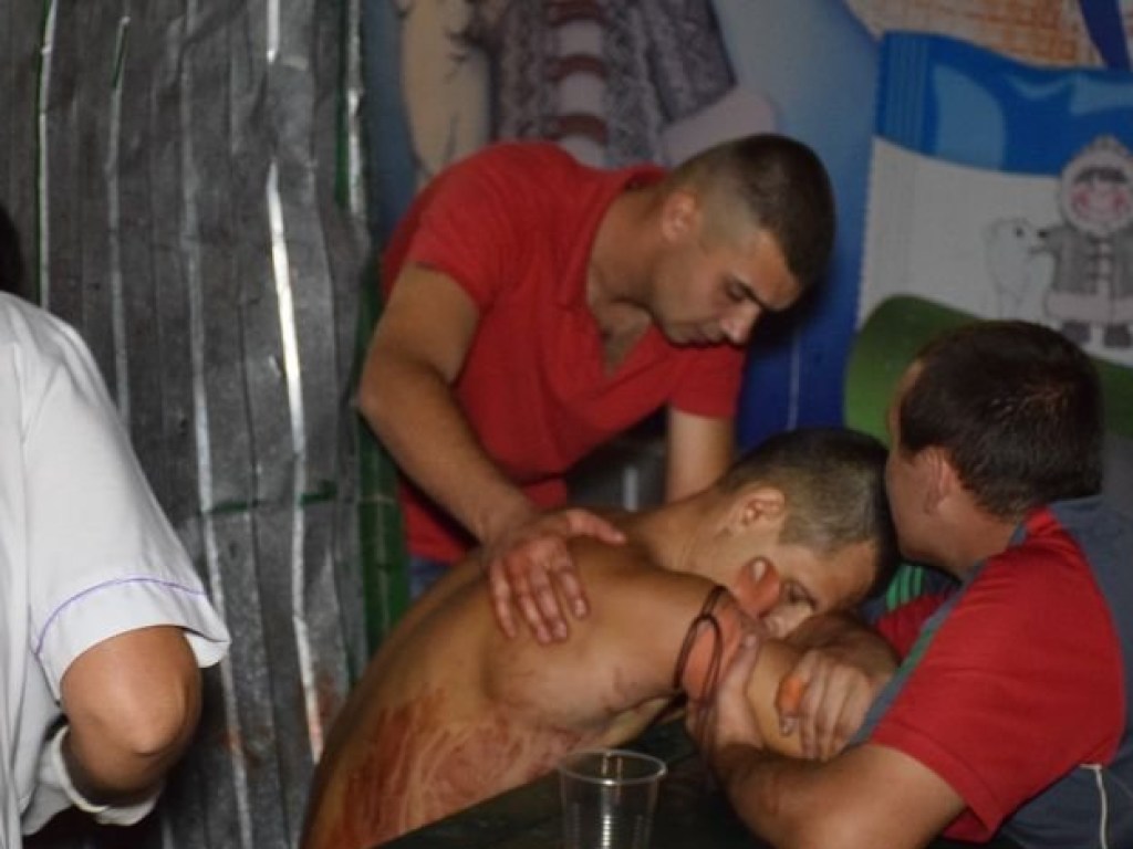 В Николаеве парень заступился за пьяного и получил от грабителей ножом (ФОТО)
