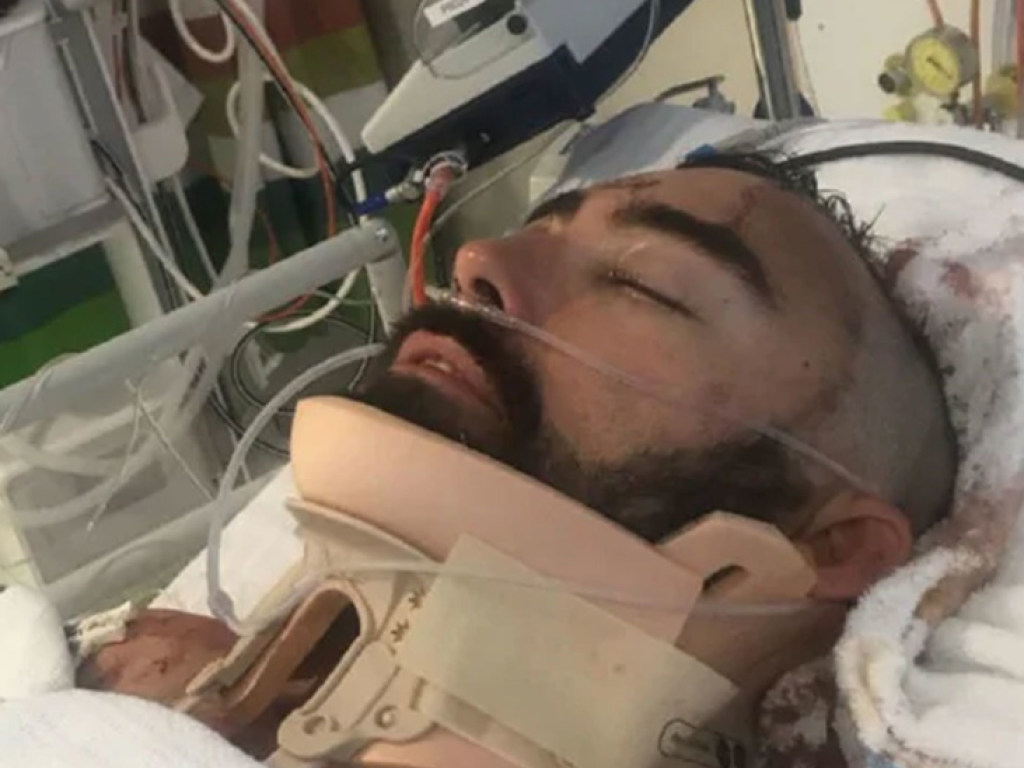 Мужчина на лету спас выпавшего с балкона сына и получил тяжелые травмы (ФОТО)