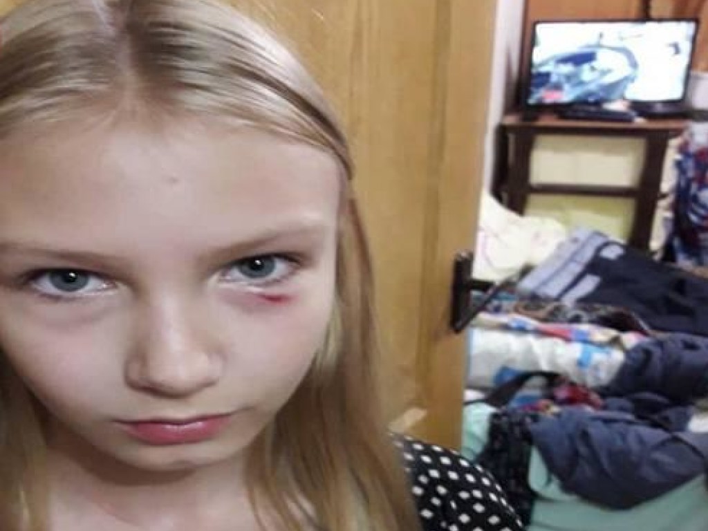 В Киеве агрессивная бабушка избила школьницу, а затем и ее отца-байкера (ФОТО)