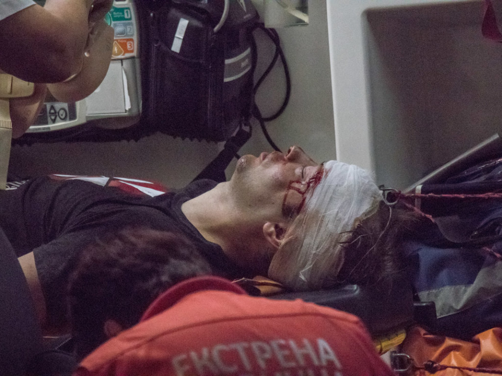 Врезался в ворота Мариинского парка: велосипедист на дороге травмировал голову (ФОТО)
