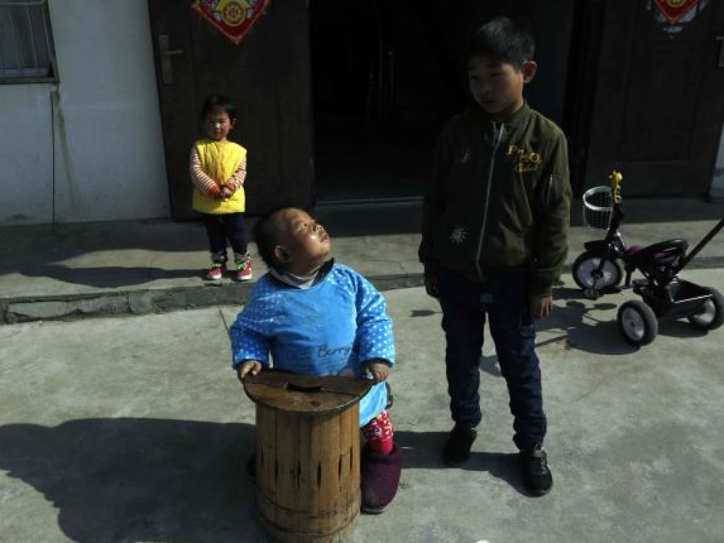31-летний китаец «заперт» в теле 4-летнего ребенка с умом как у 2-летнего (ФОТО)