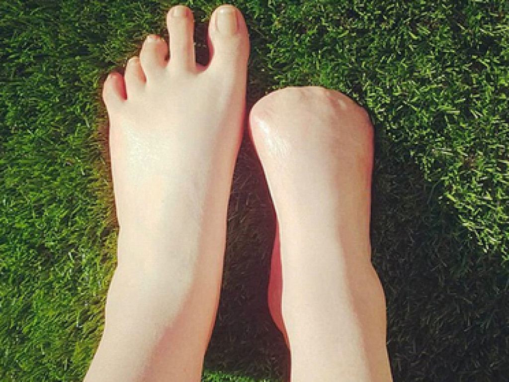 Австралийка решилась на экзотичную спа-процедуру и лишилась пальцев ноги