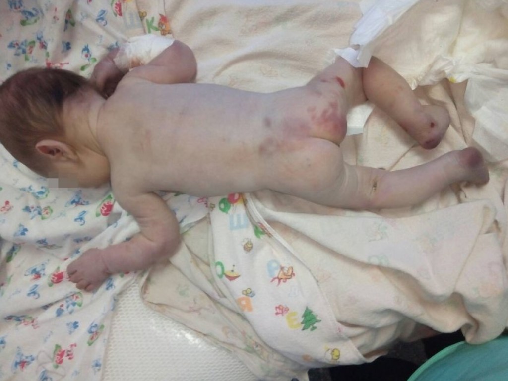 Избитого младенца в коробке нашли под дверьми больницы на Николаевщине (ФОТО)