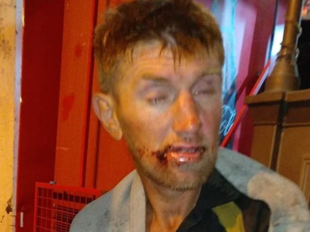 Ночью в Одессе нашли раненного мужчину в беспамятстве