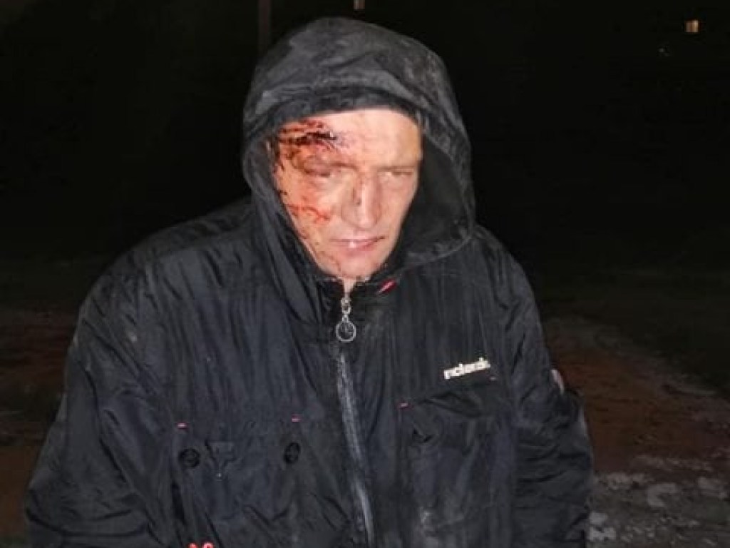 Жители Днепра устроили самосуд над насильником, который избивал девушку (ФОТО)
