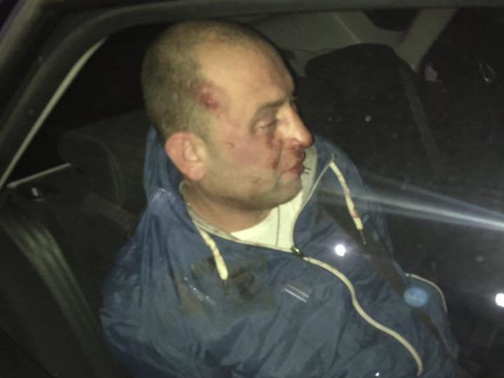 В Одессе неадекватный окровавленный мужчина с ножом напал на женщину с ребенком (ФОТО)