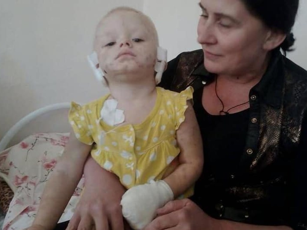 Пес откусил уши ребенку в Харькове (ФОТО)