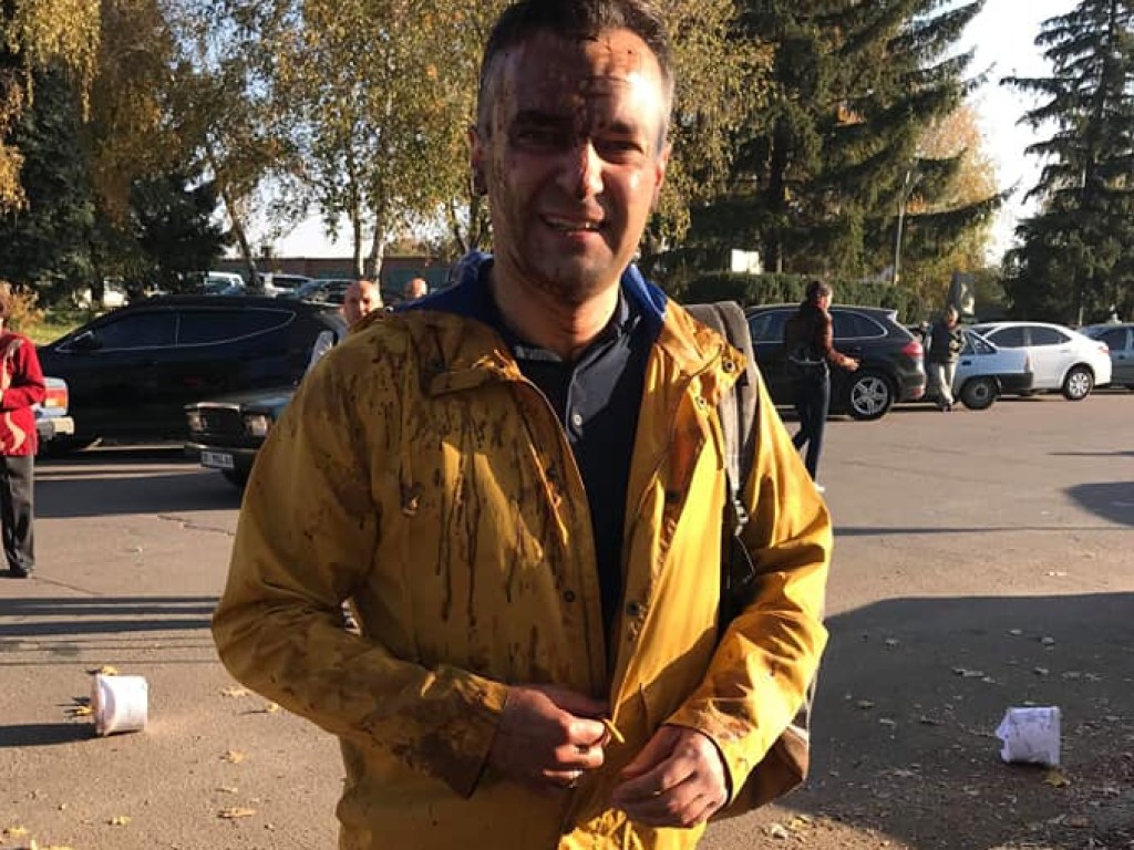 Журналиста Гнапа облили фекалиями в Полтавской области (ФОТО)