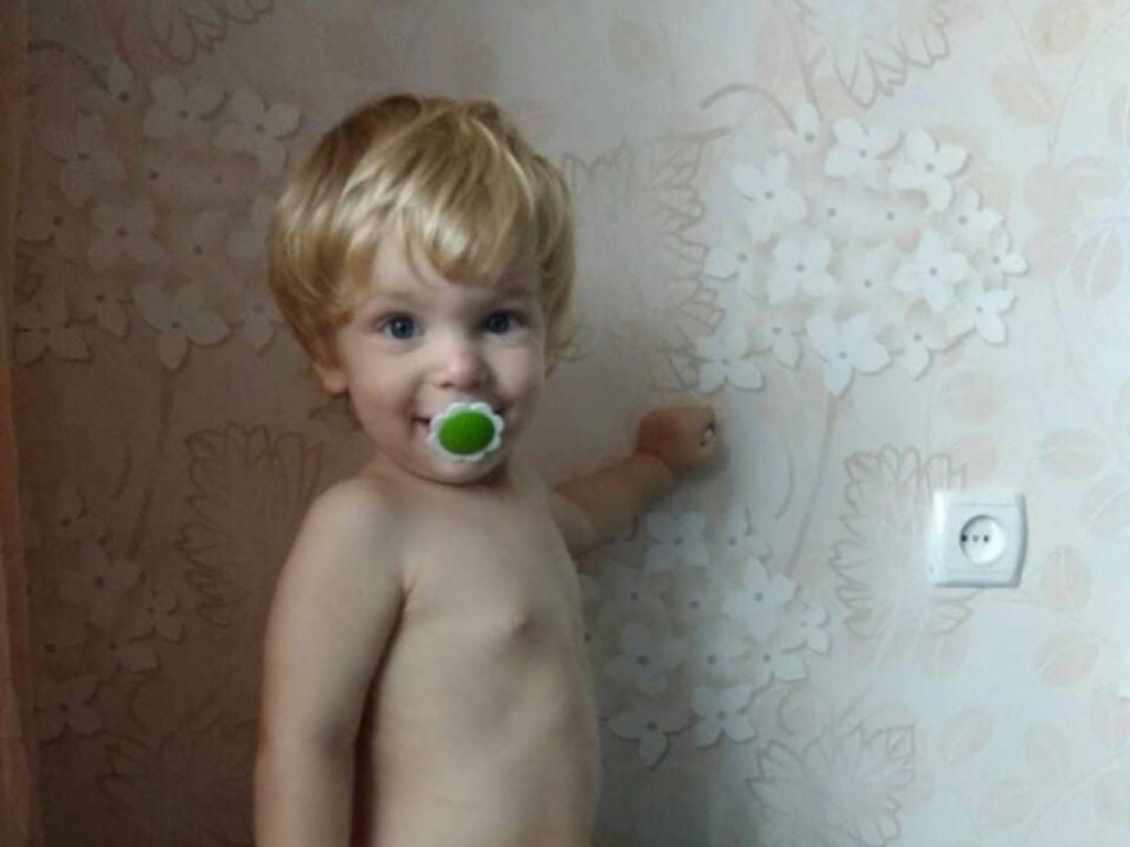 Мальчик в реанимации: В Запорожской области на 2-летнего ребенка упала кастрюля с кипятком (ФОТО)
