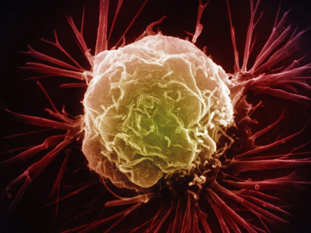 Ученые обнаружили код самоуничтожения раковых клеток