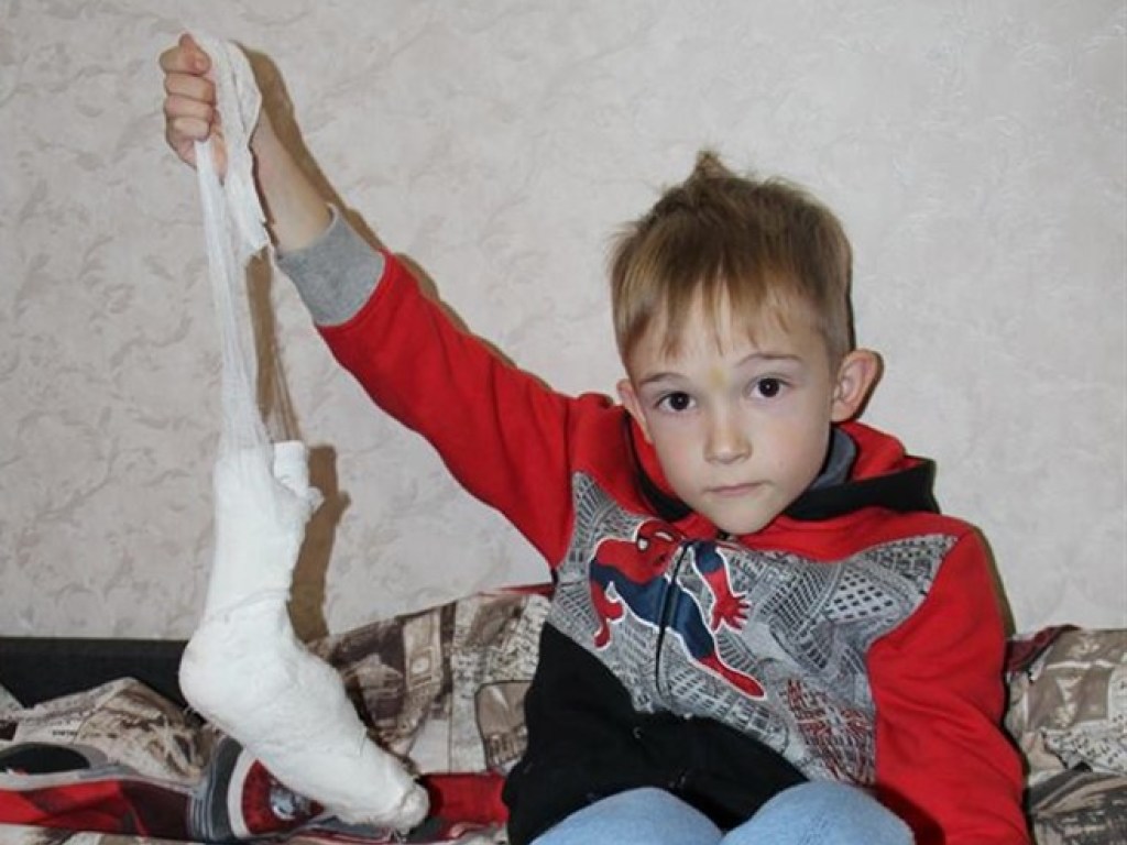 В Тернополе мальчик ходил с гипсом на здоровой ноге почти 10 дней (ФОТО)