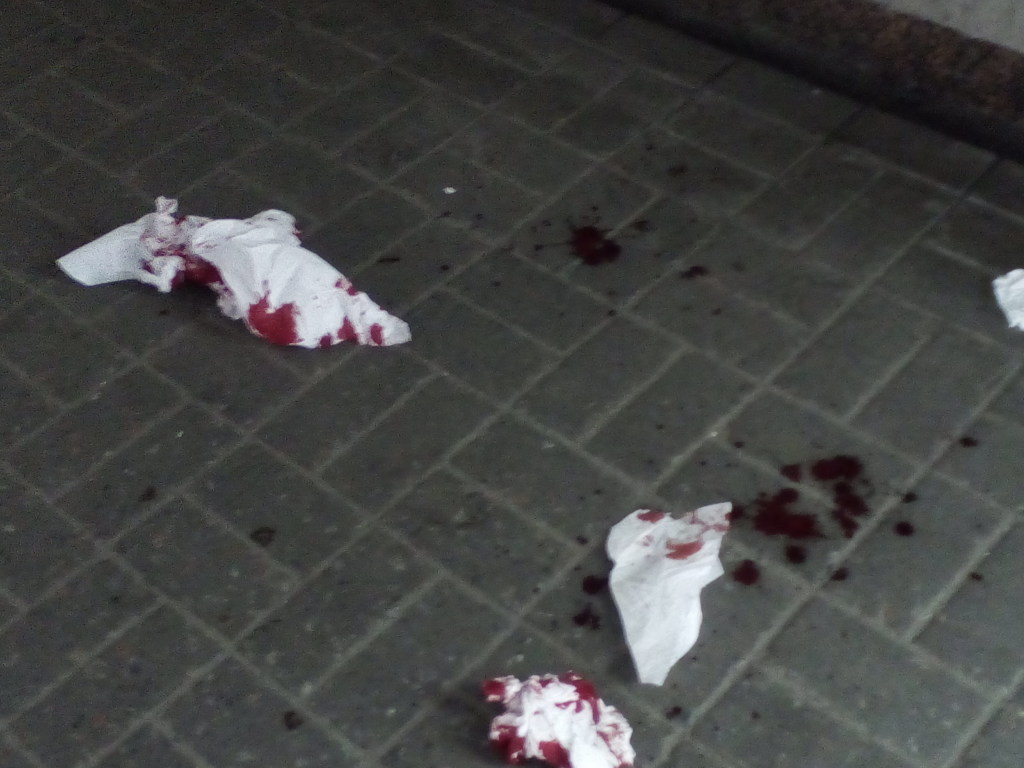 В Киеве на «Лыбедской» подрезали мужчину: возле входа в метро остались пятна крови и грязные салфетки (ФОТО)