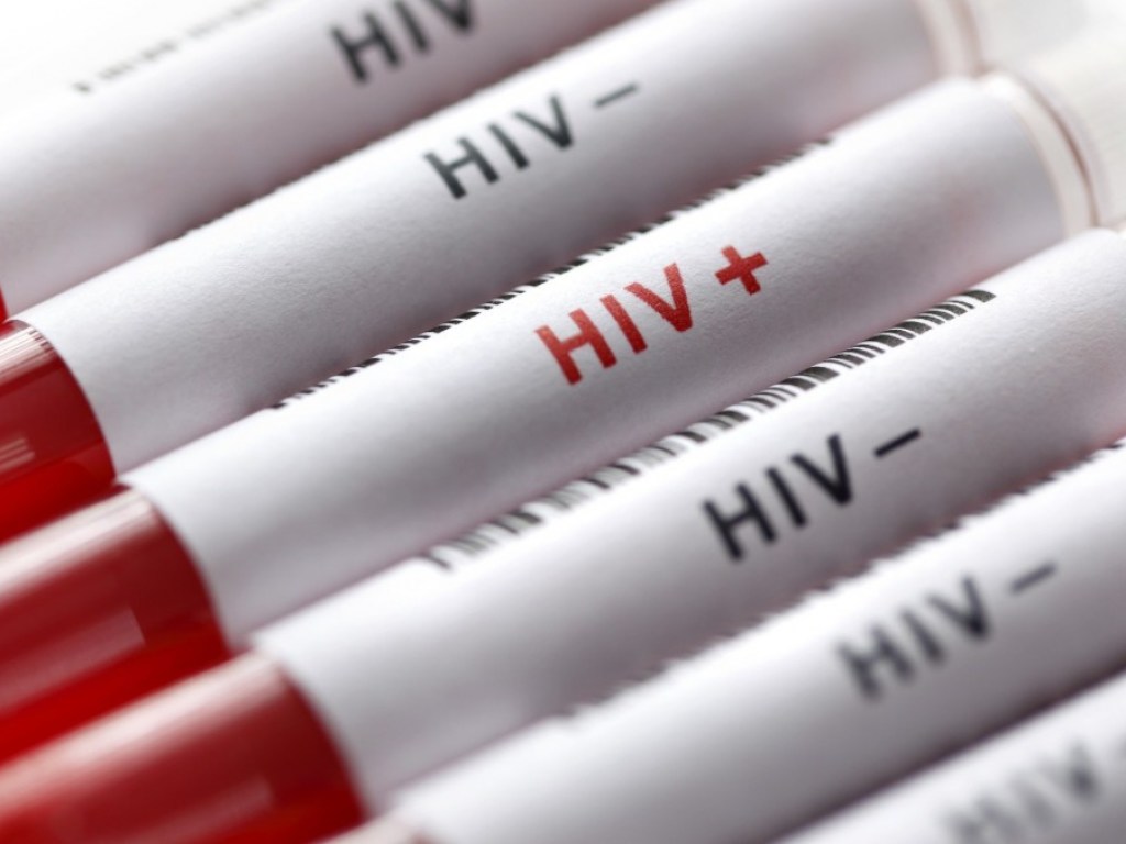 Украина оказалась в лидерах по темпам распространения ВИЧ в Европе