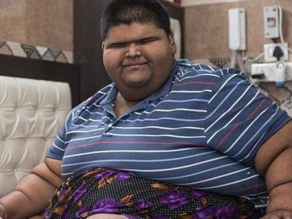 Самый толстый ребенок в мире сбросил 100 килограммов