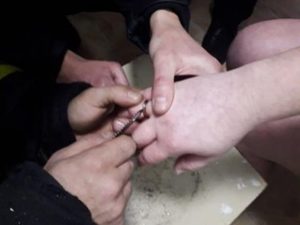 Бойцы специального назначения ГСЧС помогли жительнице Черкасс снять обручальное кольцо (ФОТО)