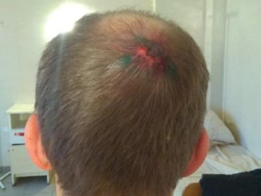 В Одессе брат экс- прокурора разбил голову прохожему за замечание (ФОТО)