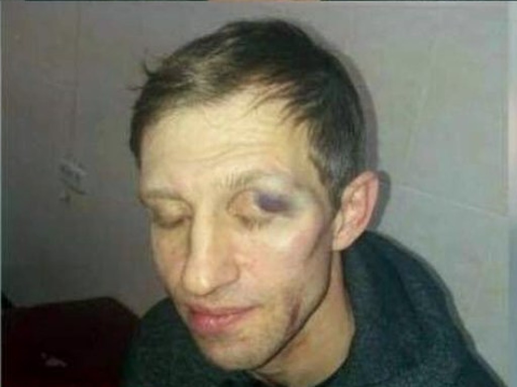 Избиение учителя физкультуры в Киеве: в МОЗ дали оценку происходящего