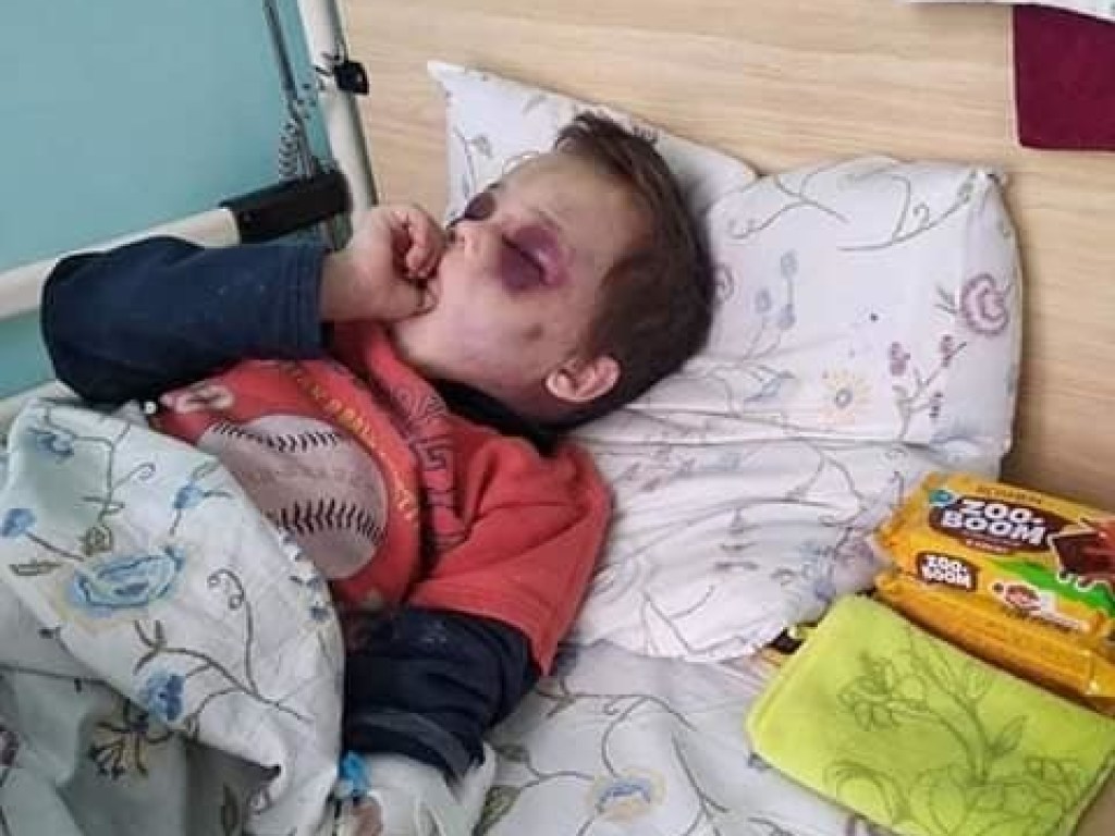 Появились подробности зверского избиения 6-летнего мальчика в Винницкой области