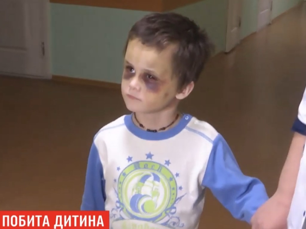 Зверское избиением мальчика в Винницкой области: СМИ узнали подробности (ФОТО, ВИДЕО)