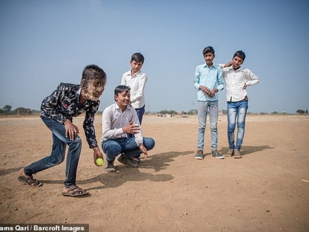 Мальчик-оборотень пугает жителей Индии, в него бросают камни (ФОТО)