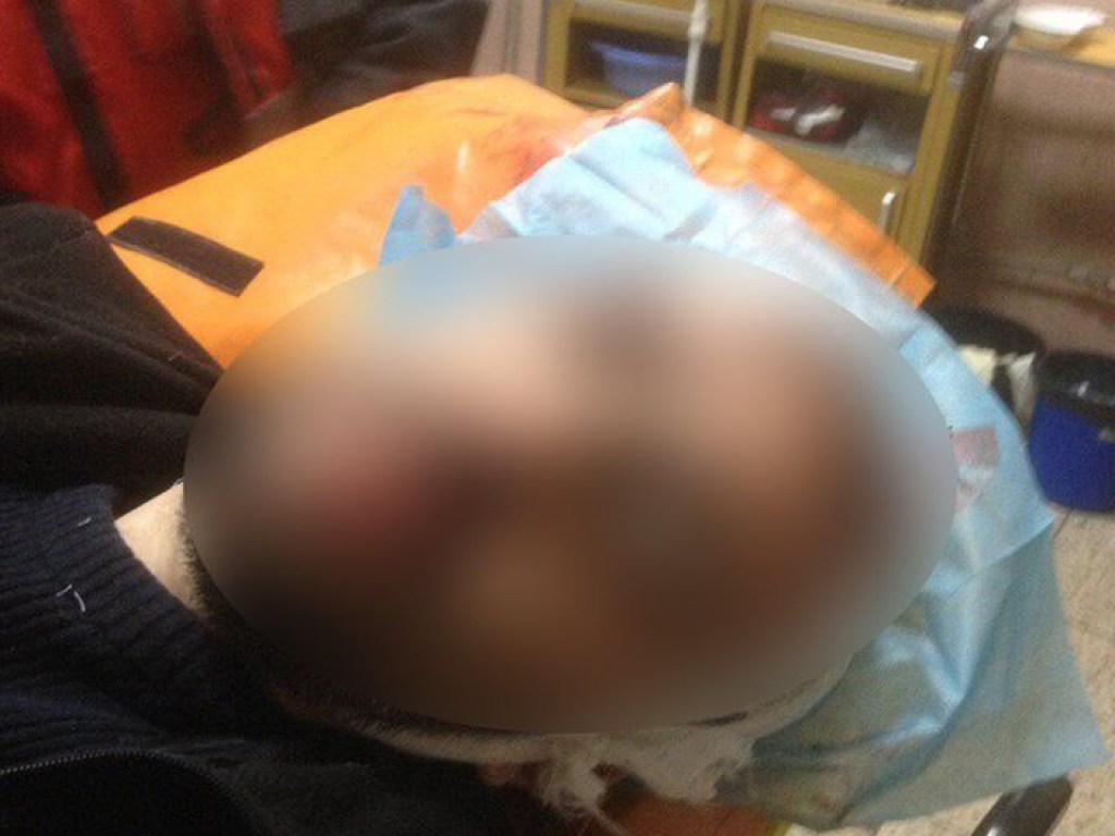 В Киеве пьяный коп нанес ножевые ранения своему коллеге (ФОТО)