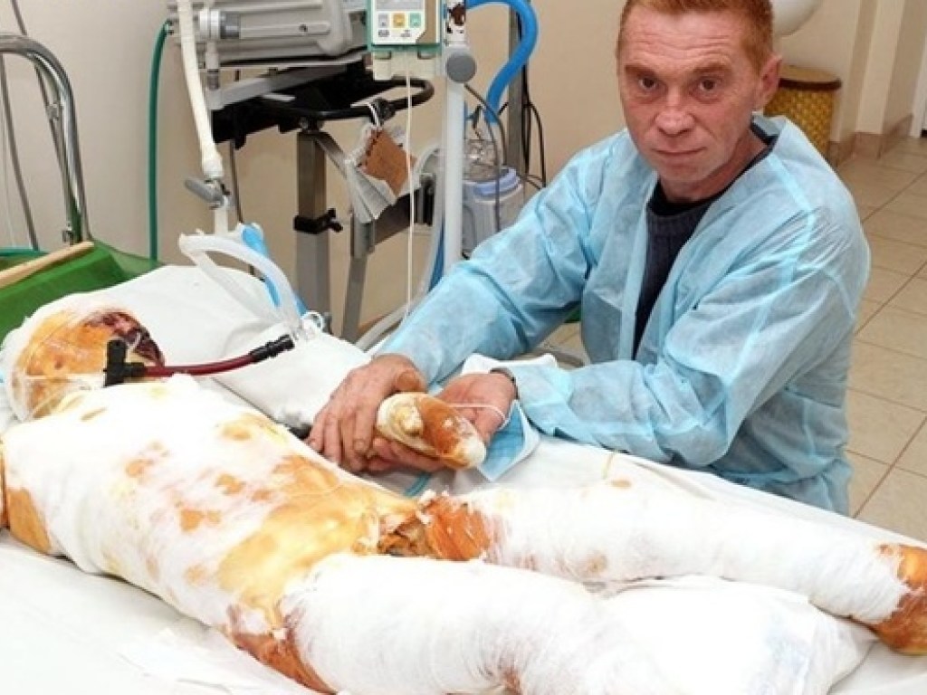На Николаевщине родители бросили в больнице сына, который чудом выжил после удара током (ФОТО)