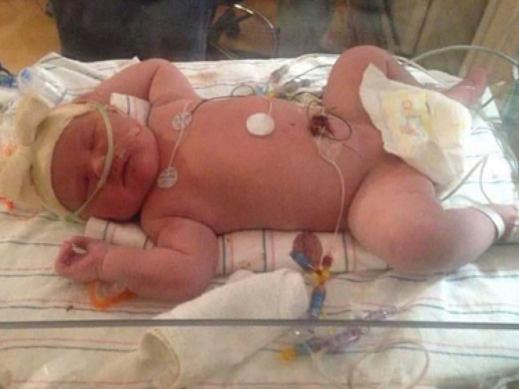 «6,9 килограмма, а рост — 59 сантиметров»: жительница США родила гигантскую дочурку (ФОТО)