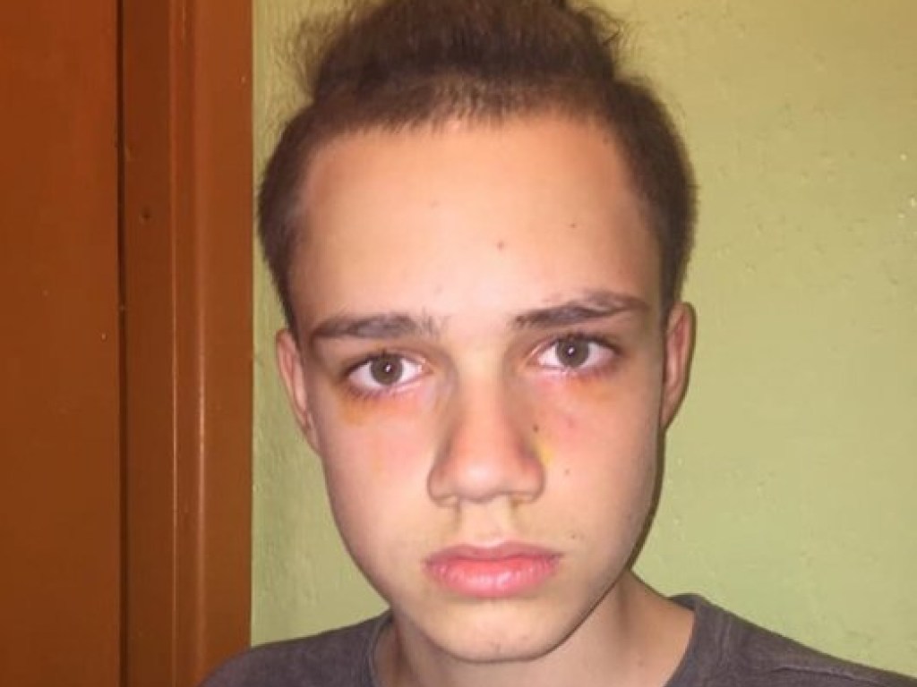 Мальчик не там присел: в Одессе охранник ТРЦ покалечил несовершеннолетнего (ФОТО)