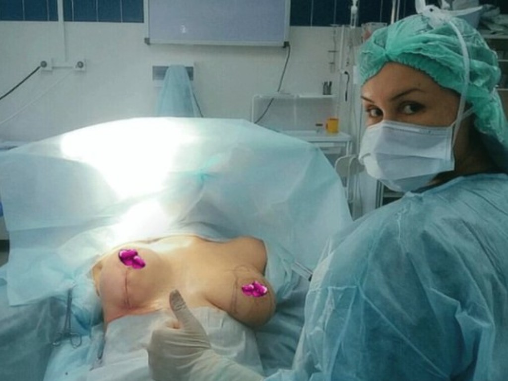 «Она меня так сшила, что по бокам торчала кожа»: Лжепластический хирург изуродовала более 10 своих пациенток (ФОТО)