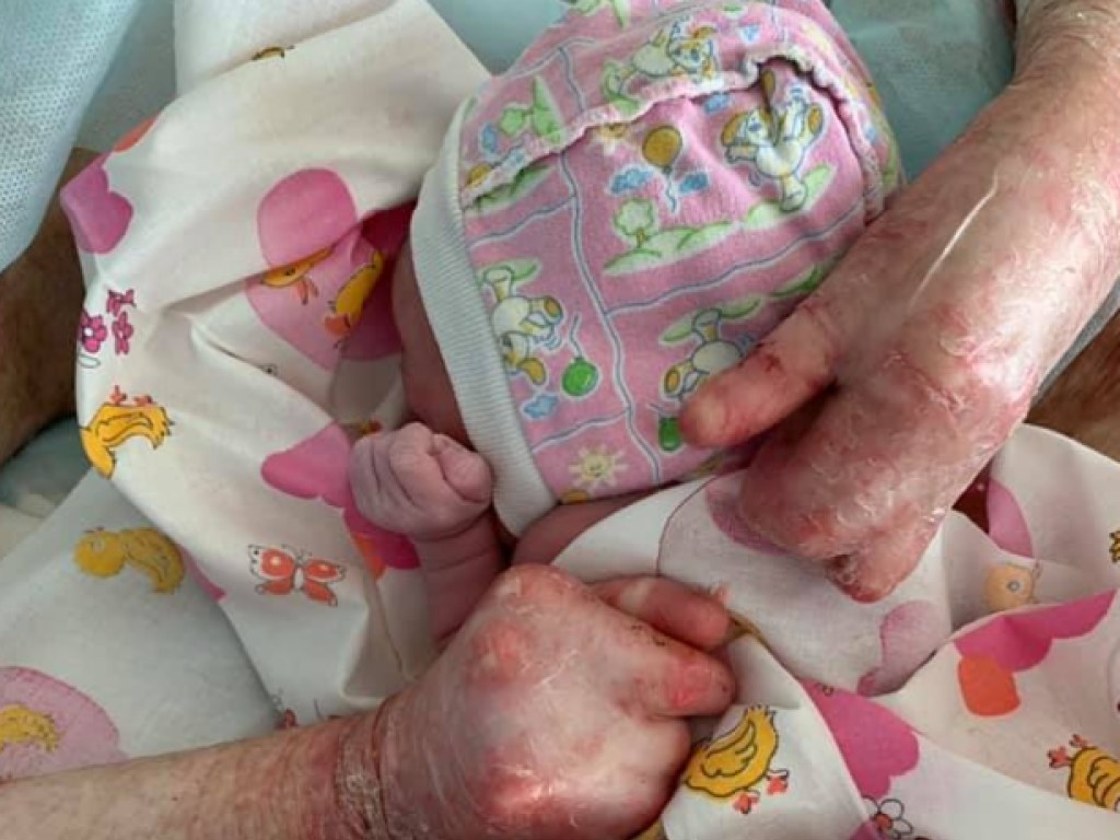 Чудо в больнице: в Днепре женщина с ужасным заболеванием родила здорового ребенка (ФОТО)
