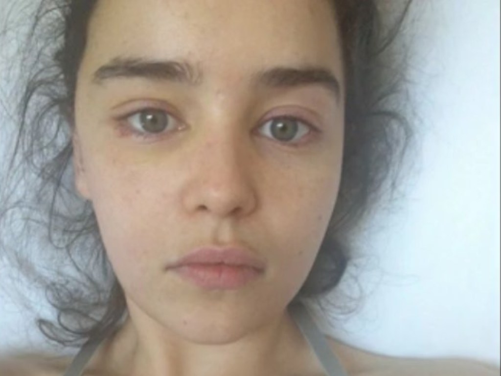Худая и обессиленная: фото Эмилии Кларк после инсульта попали в Сеть