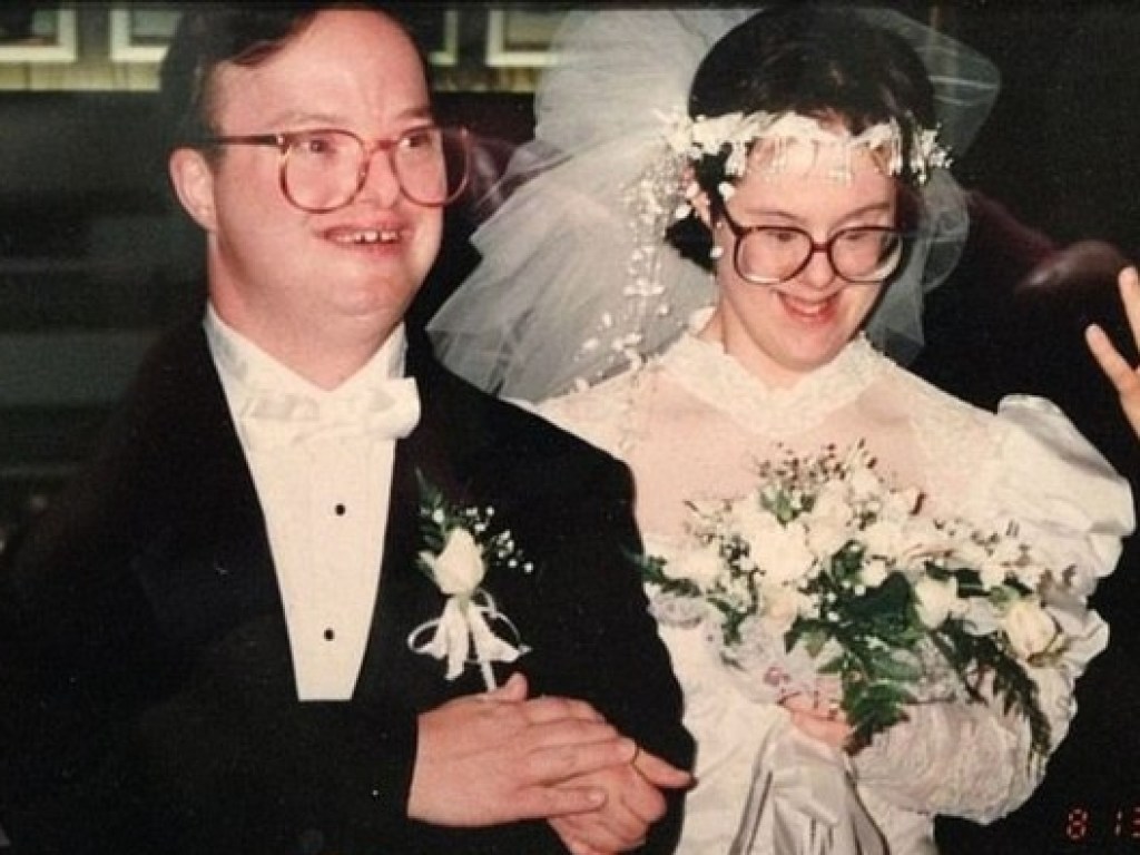Вместо прожили 25 лет: завершился самый длительный в истории брак с синдромом Дауна (ФОТО)
