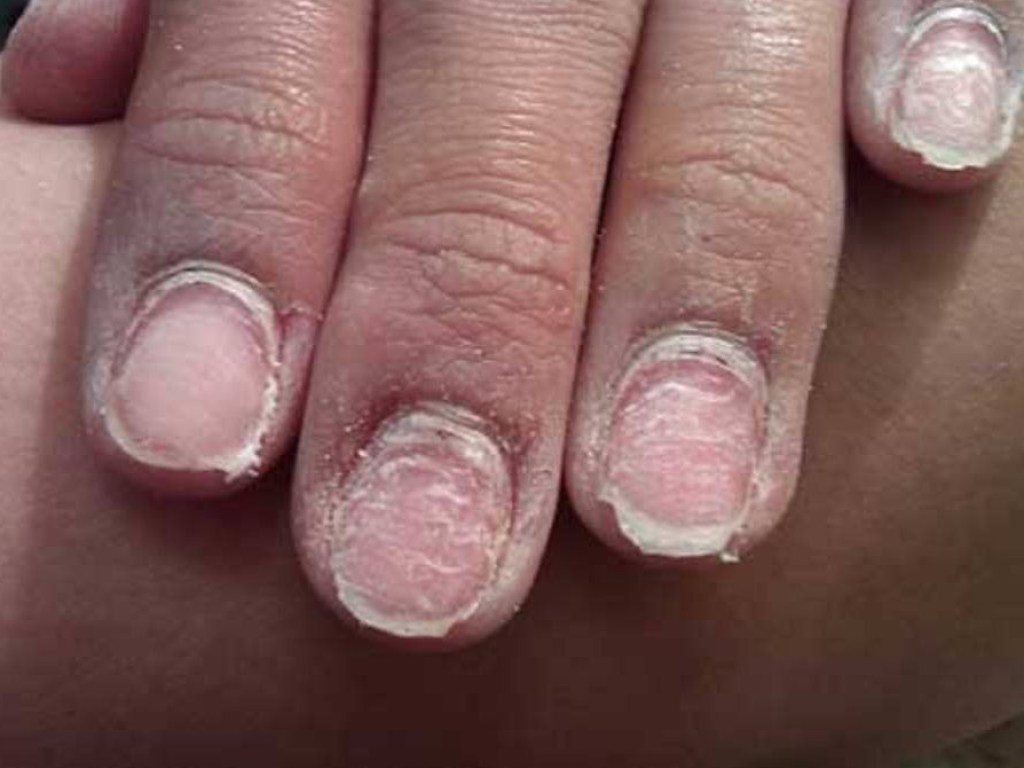 Уничтожает ногти: Названа главная опасность гель-лака