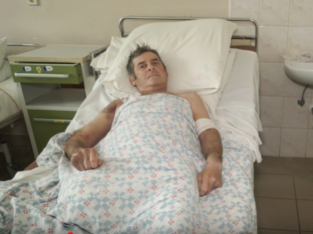 В Мукачево собака до кости обгрызла ногу хозяину: видео из больницы