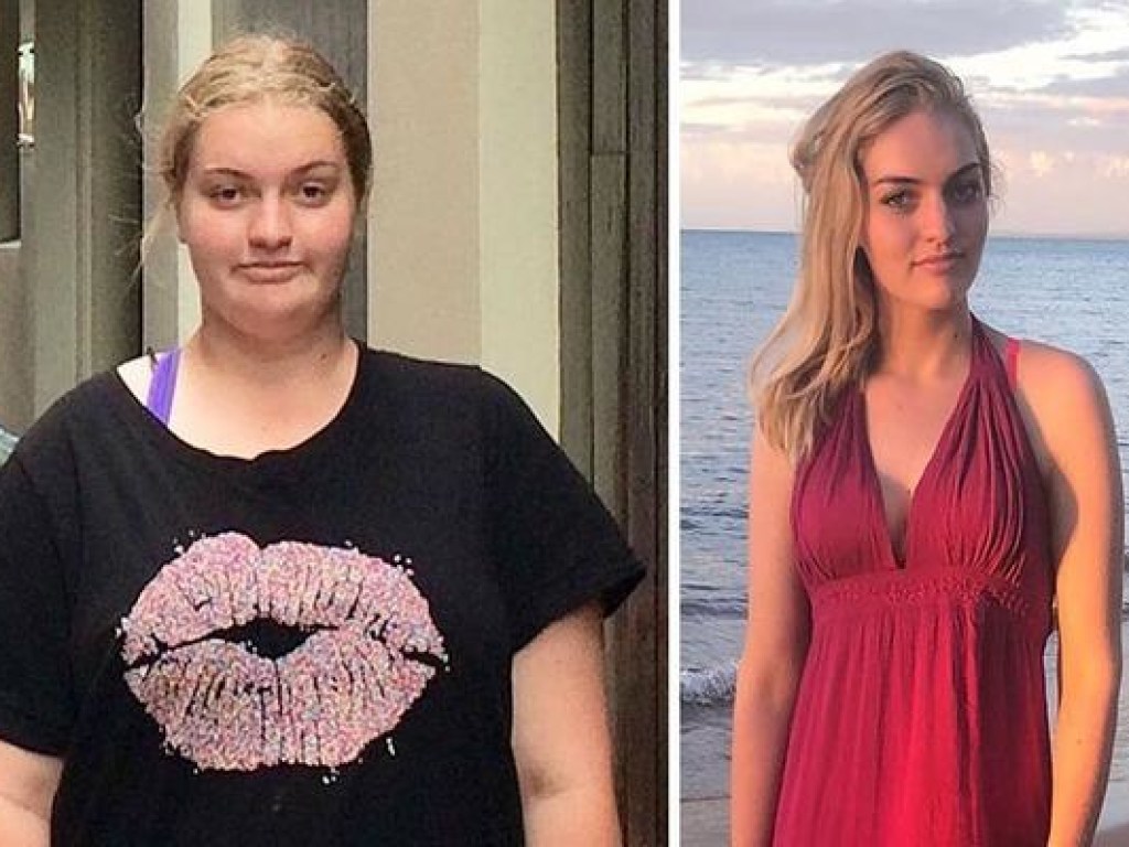 Жевала, не переставая: Неожиданный продукт помог австралийской девушке похудеть на 63 килограмма (ФОТО)