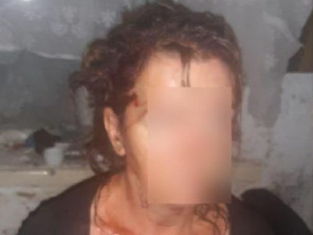 В Днепре пьяная женщина облила кипятком своего сожителя (ФОТО)