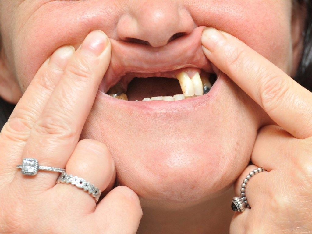 К чему снится выпадение зубов: эксперт раскрыла тайну снов